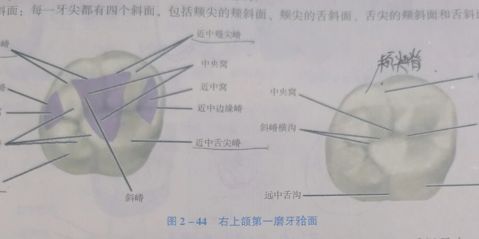 3 近中邻面有近中沟(有特例)4 远中边缘嵴长于近中边缘嵴(上4边缘嵴