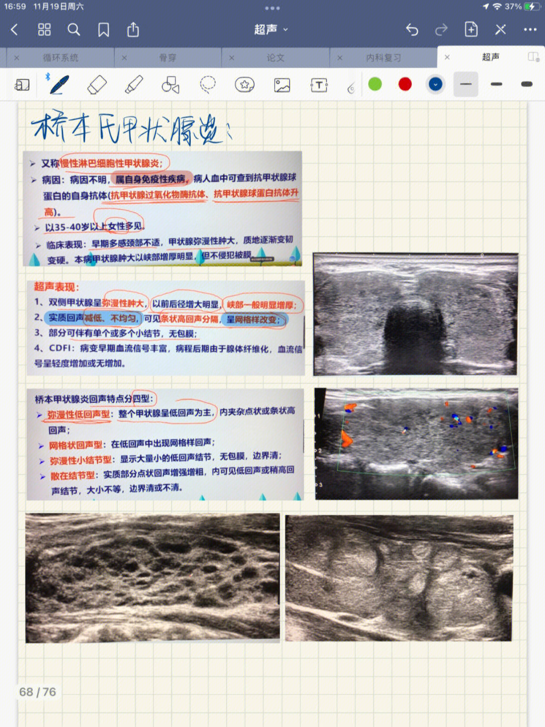 超声笔记甲状腺疾病