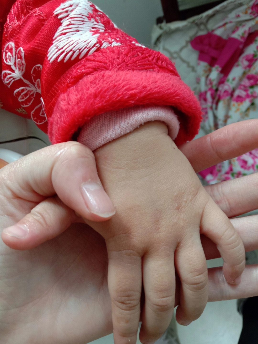 女儿手上起小米粒疙瘩图片