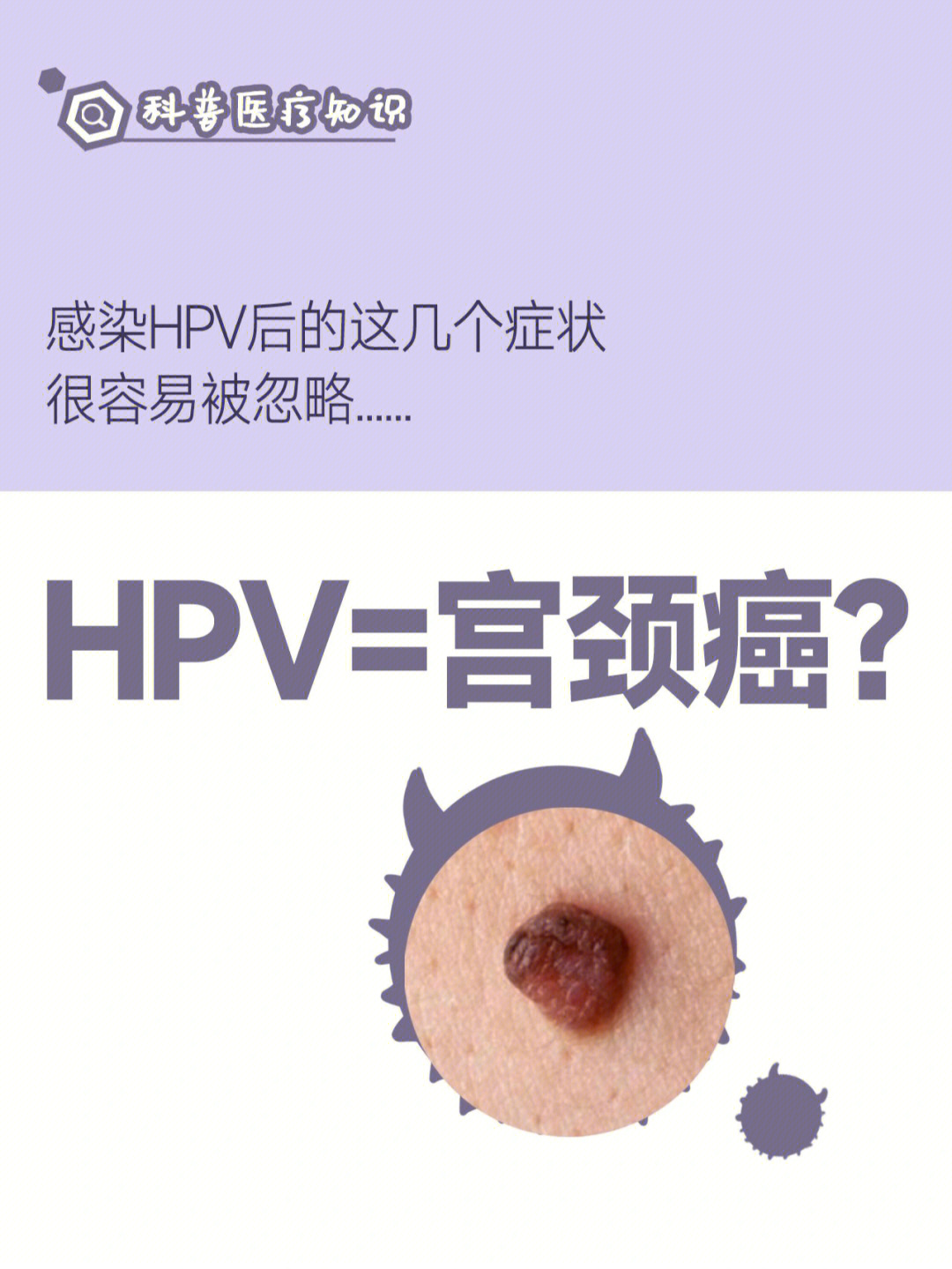 感染hpv后的这几个症状,很容易被忽略-感染hpv的症状-感染hpv病毒=得