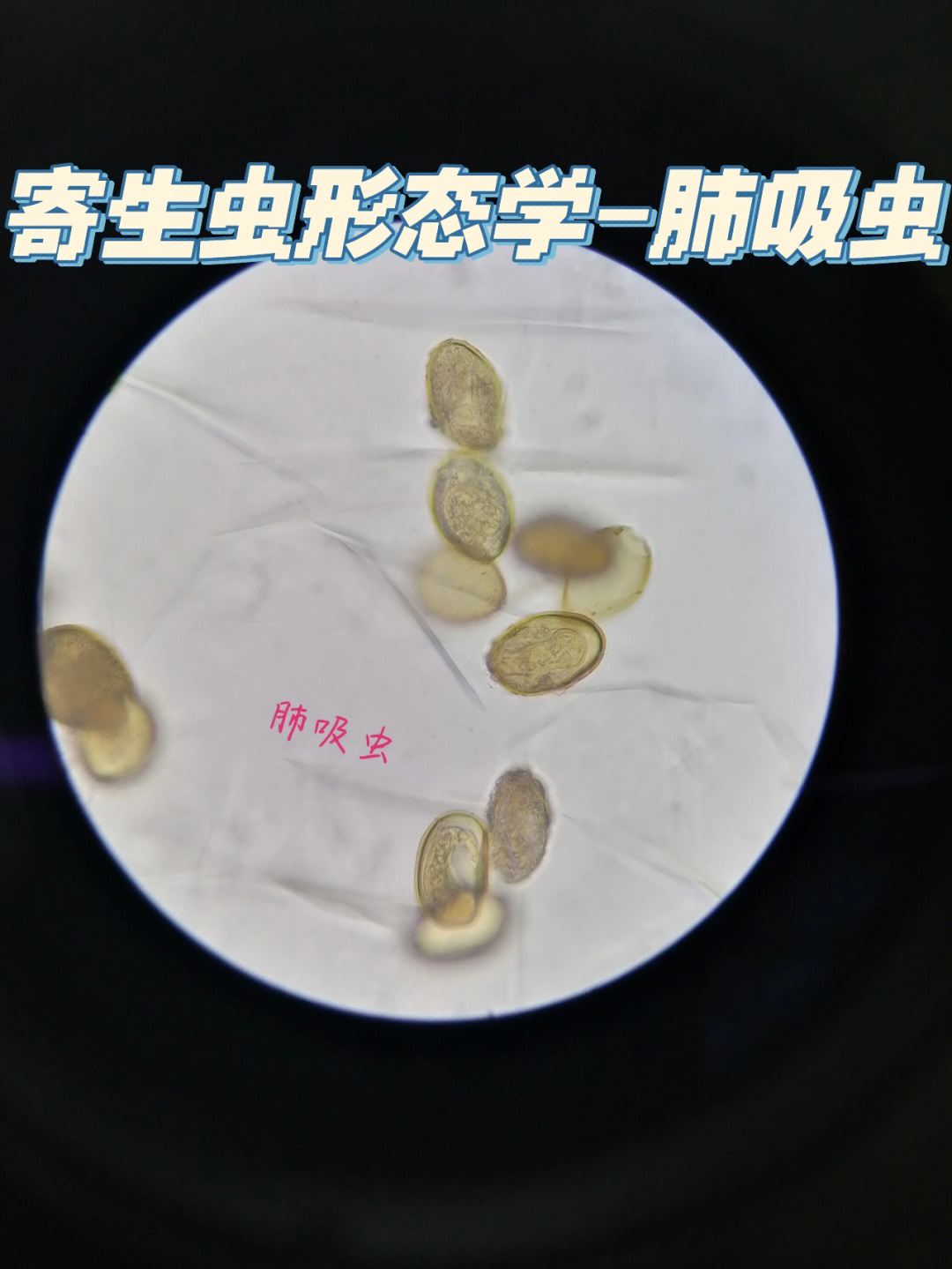 肺吸虫显微镜图片