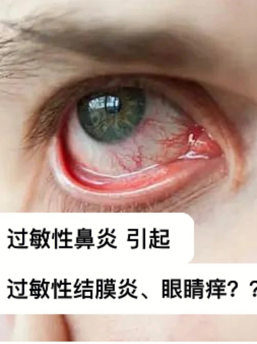 增加眼周血液循环,很好缓解眼部干痒