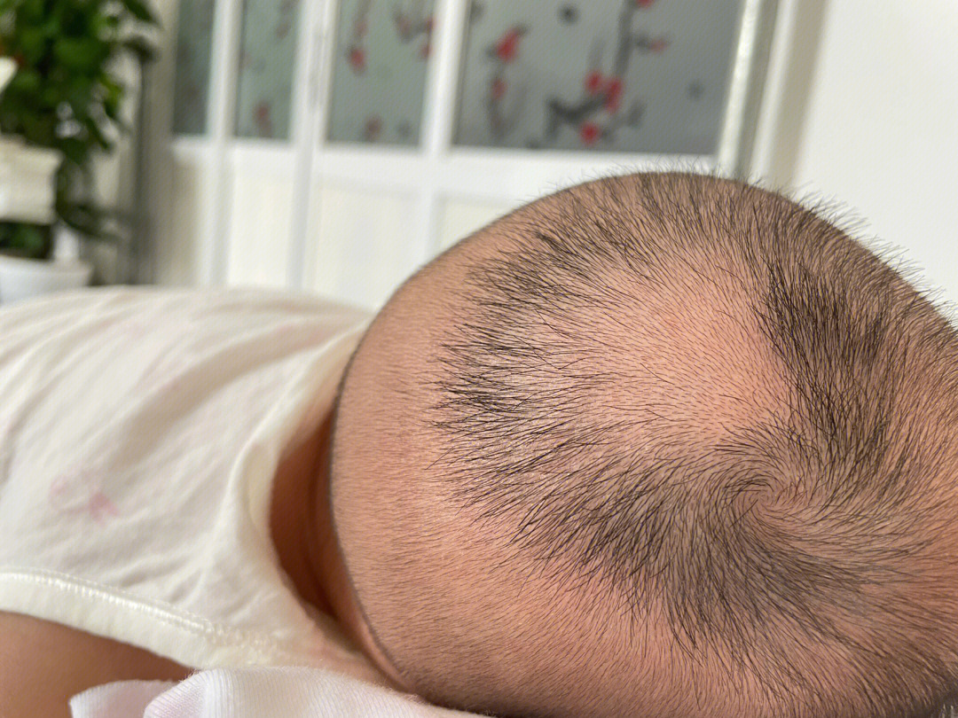 宝宝头发不均匀图片图片