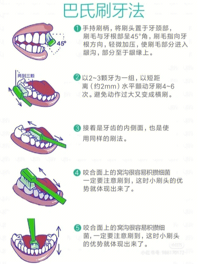 牙龈出血怎么治疗图片