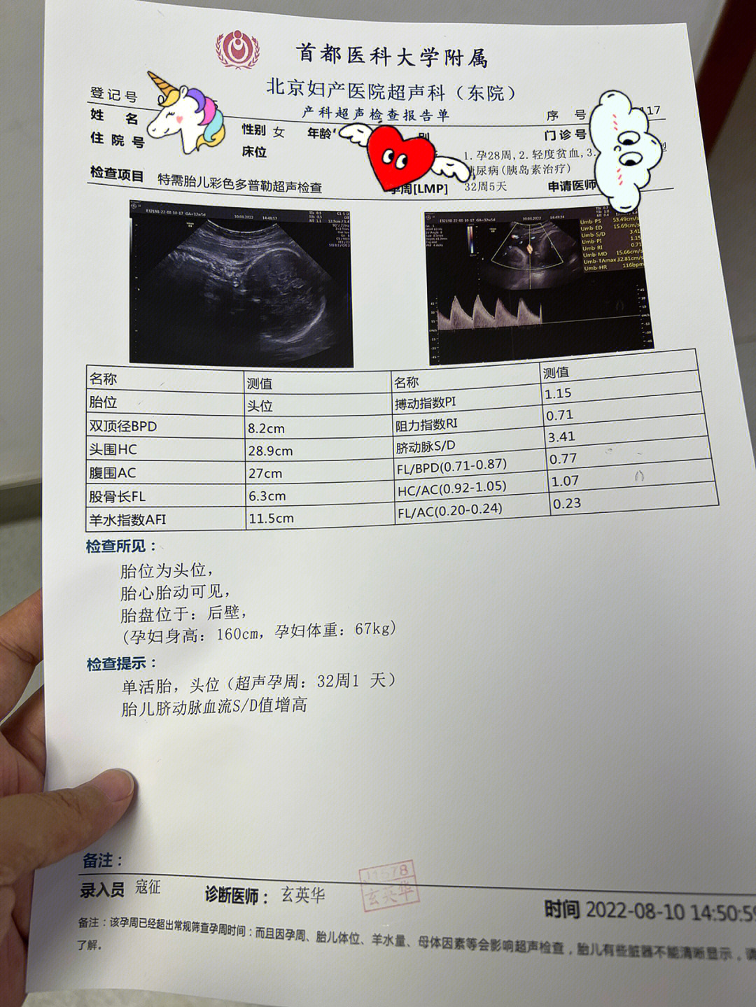 孕周与脐血流对照表图片