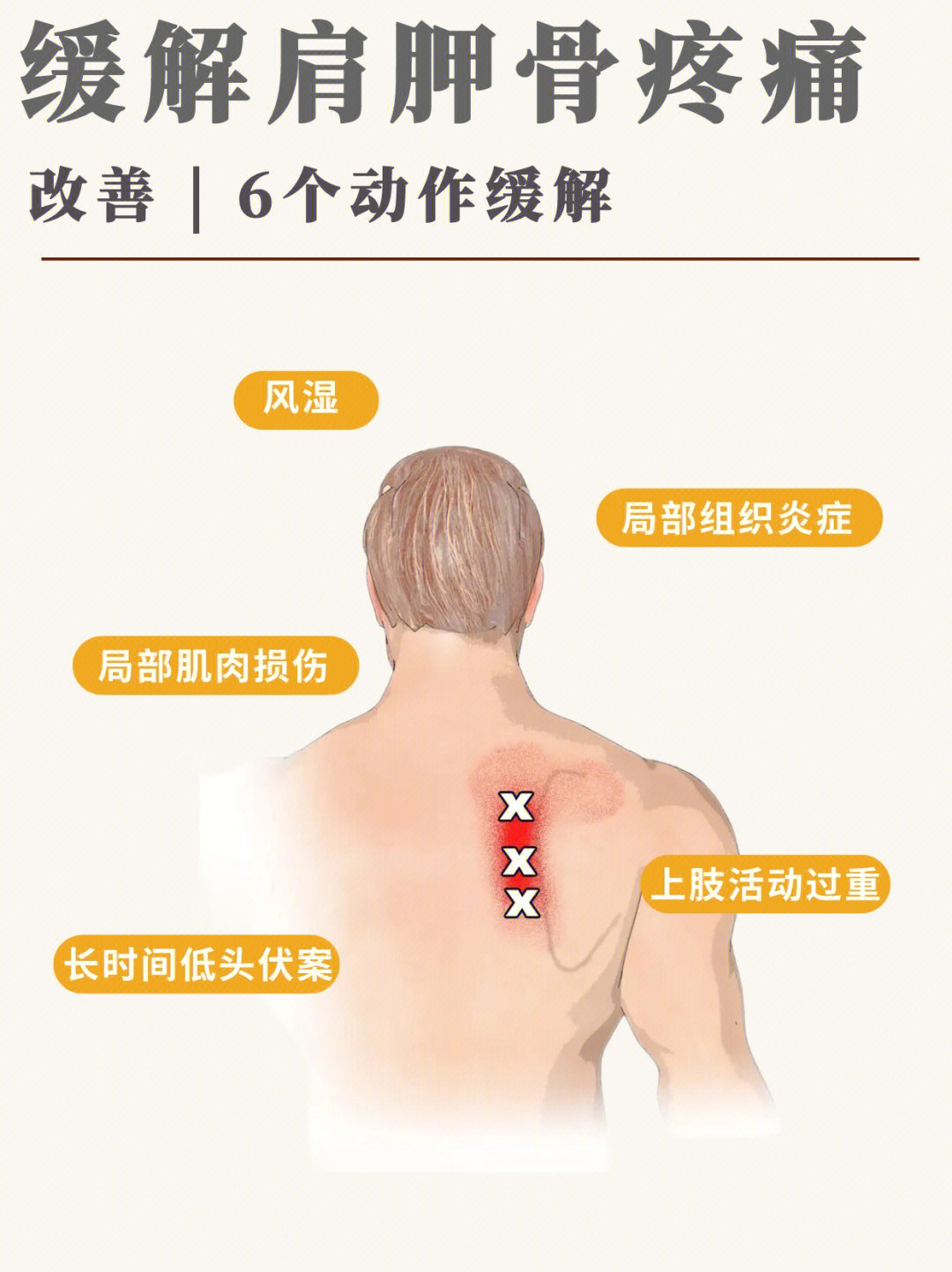 肩胛骨缝疼图图片