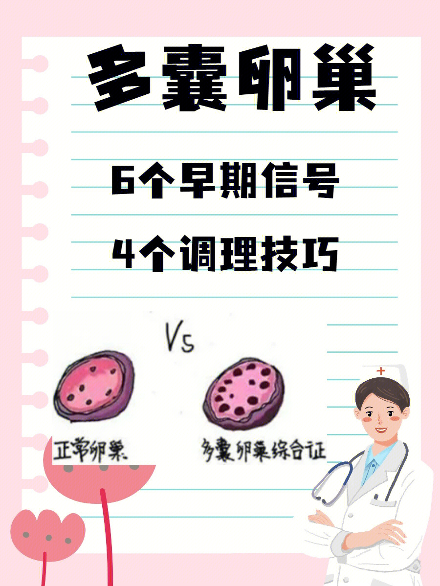 但是一定找个好医生因为中医认为多囊卵巢综合征的病因为禀赋不足,素