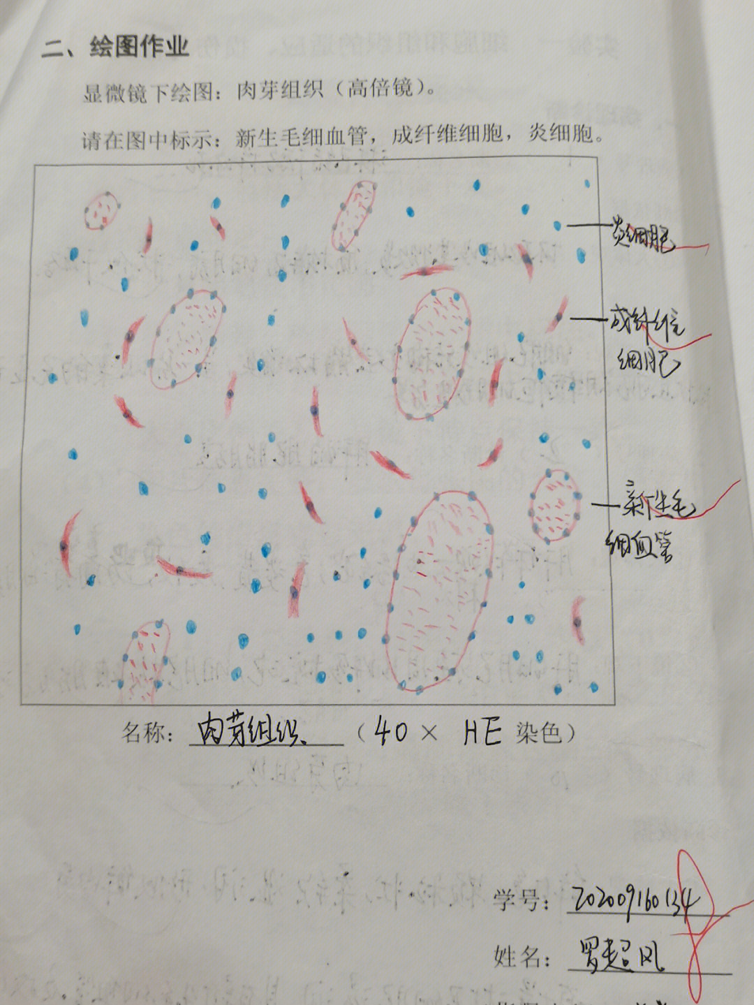 p1肉芽组织p2各炎细胞p3大叶性肺炎灰色肝样变期p4肝硬化