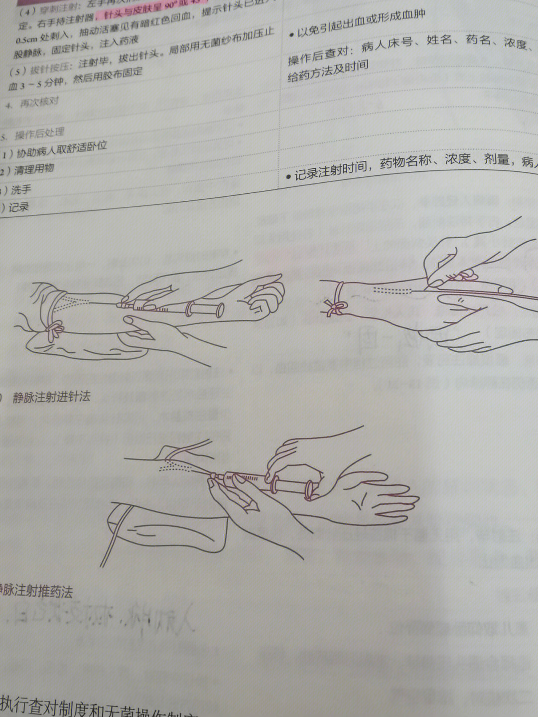 静脉的注射部位及角度图片