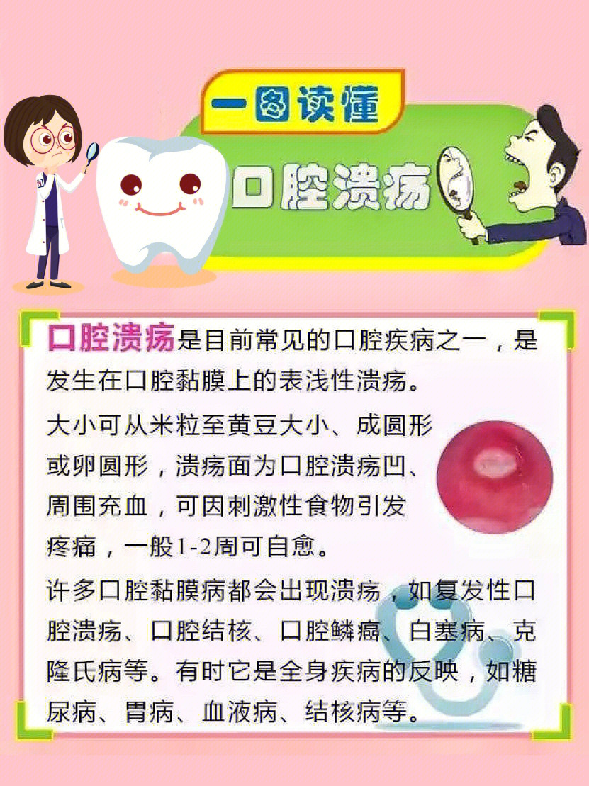 口腔溃疡会什么总是反复