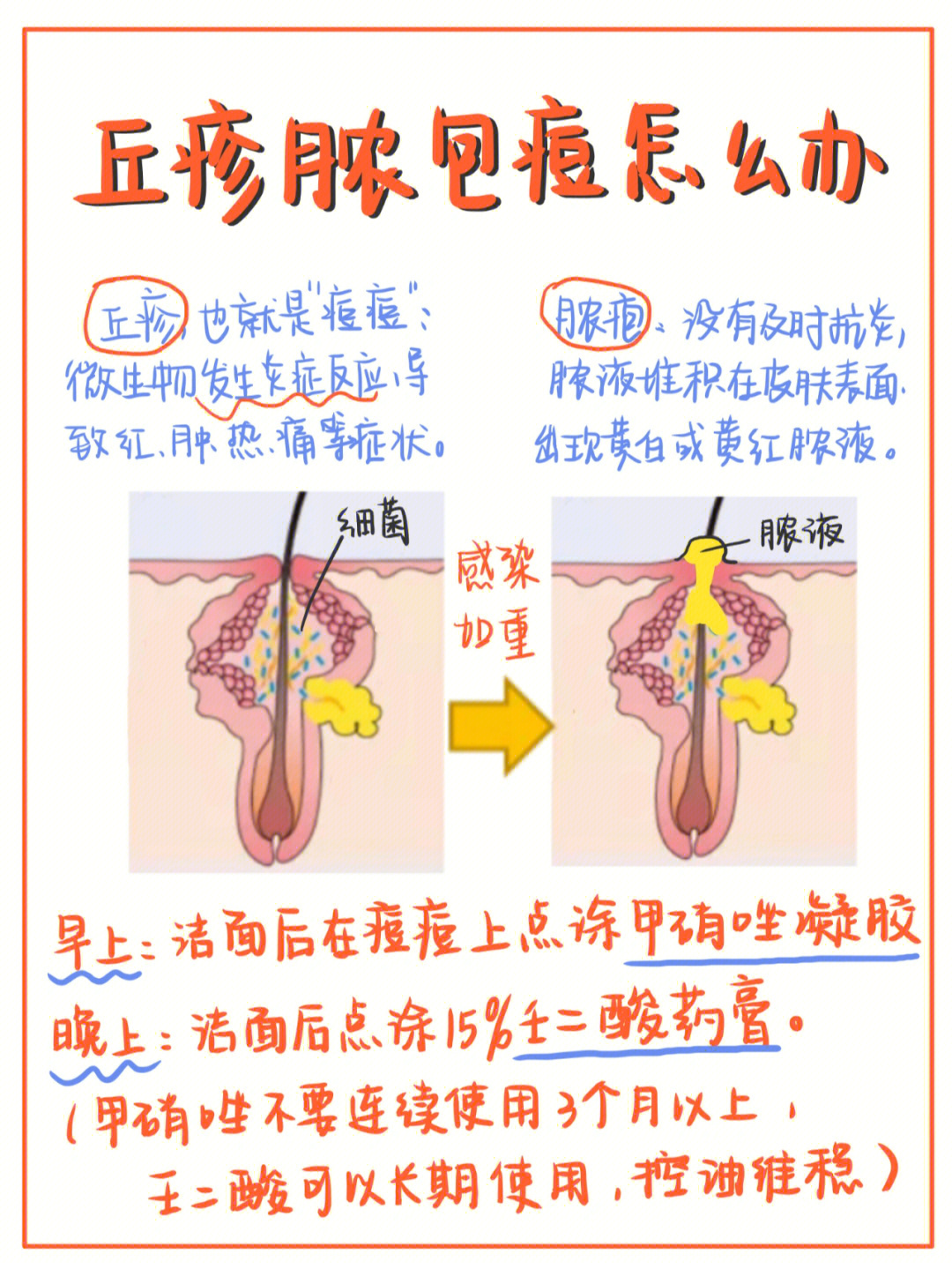 丘疹痘痘的治疗方法图片