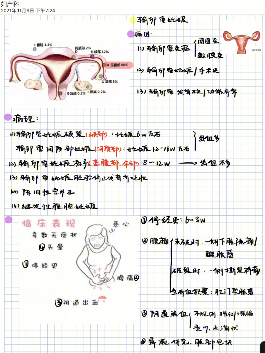 异位妊娠思维导图模板图片