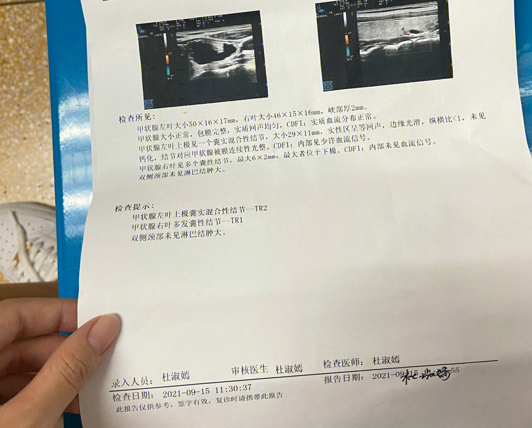 甲状腺囊实性结节3cm