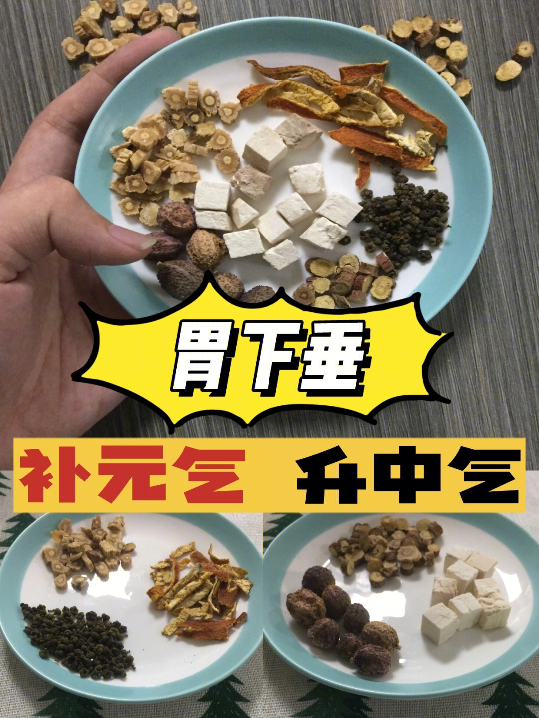 胃下垂图片真实图片