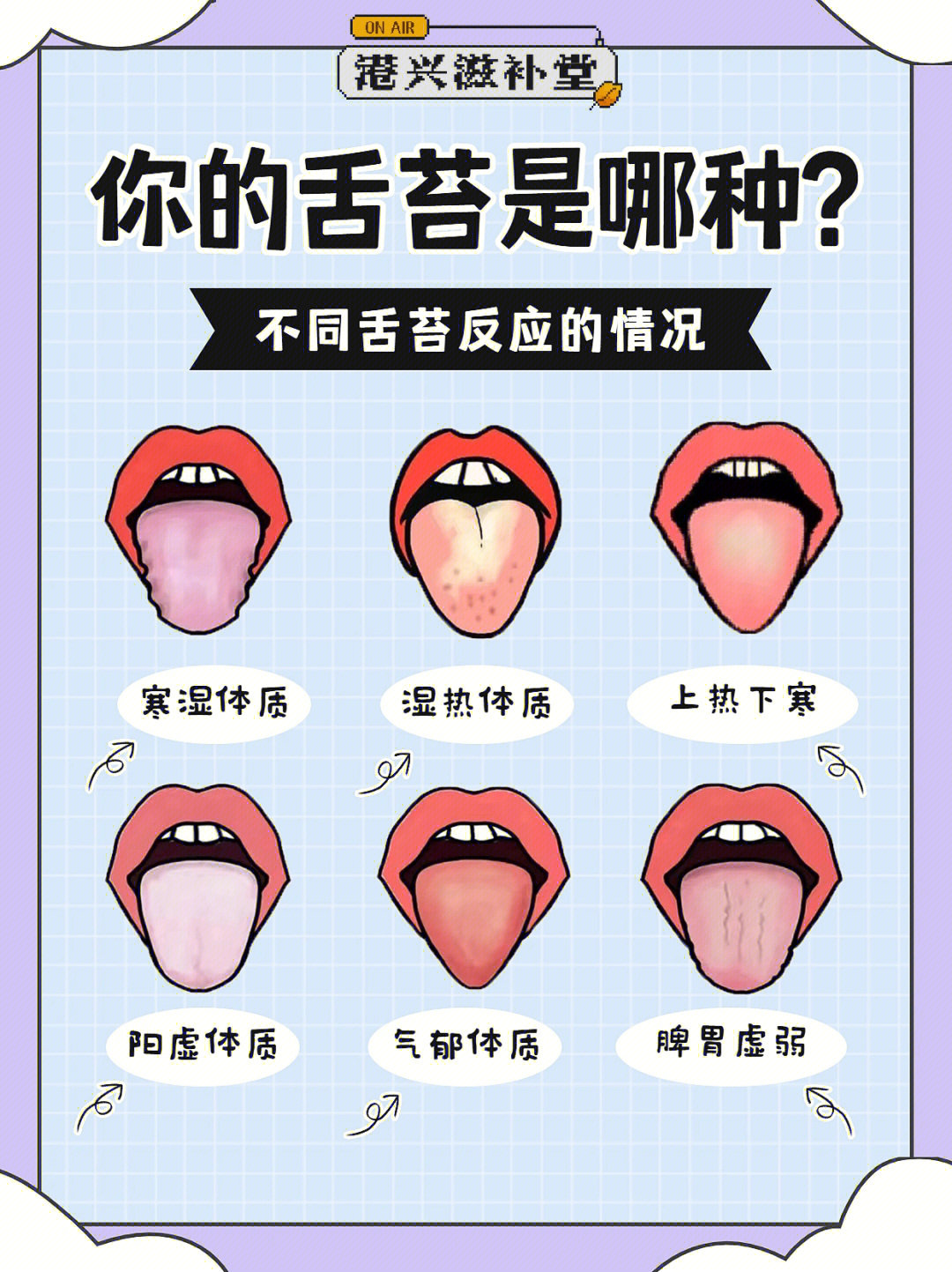 怎样的舌苔算正常图片图片