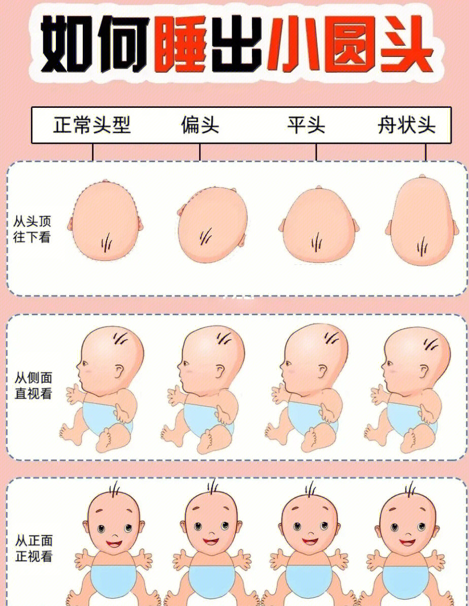 宝宝头围偏小图片