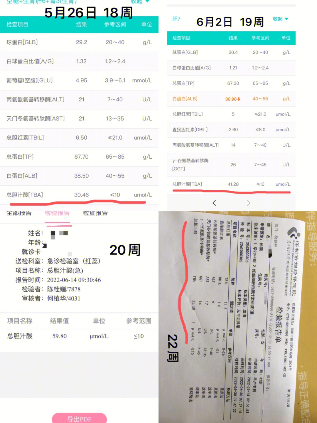 总胆汁酸高说明什么图片