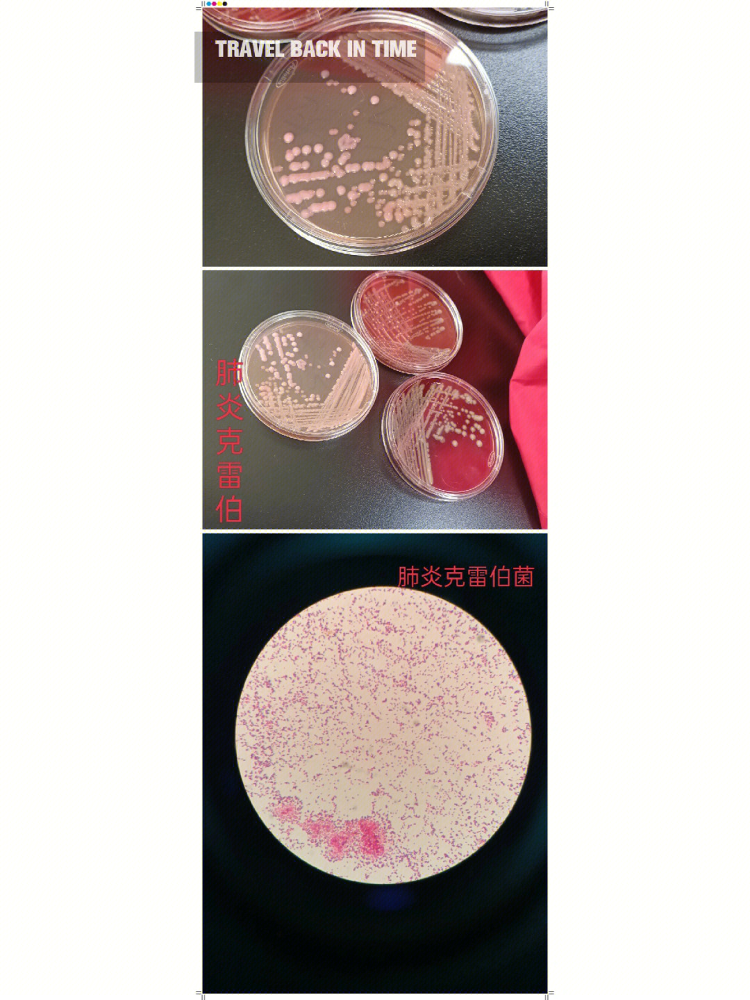 白喉棒状杆菌镜下形态图片