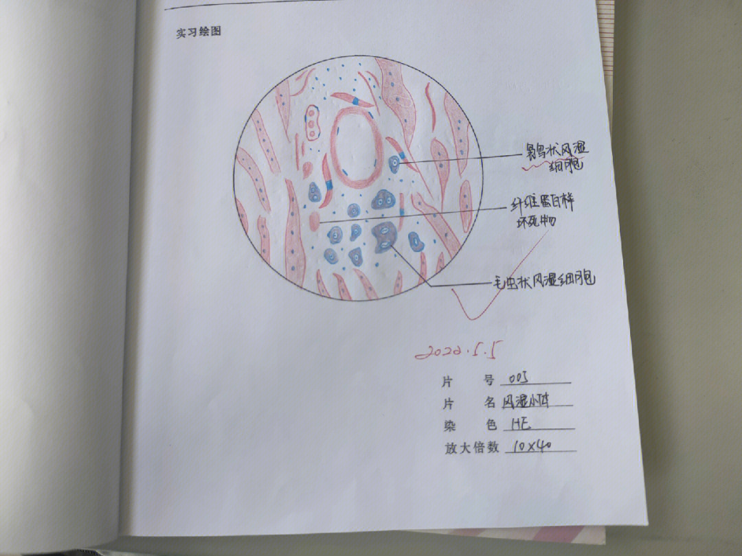 肺炎链球菌 红蓝铅笔图片