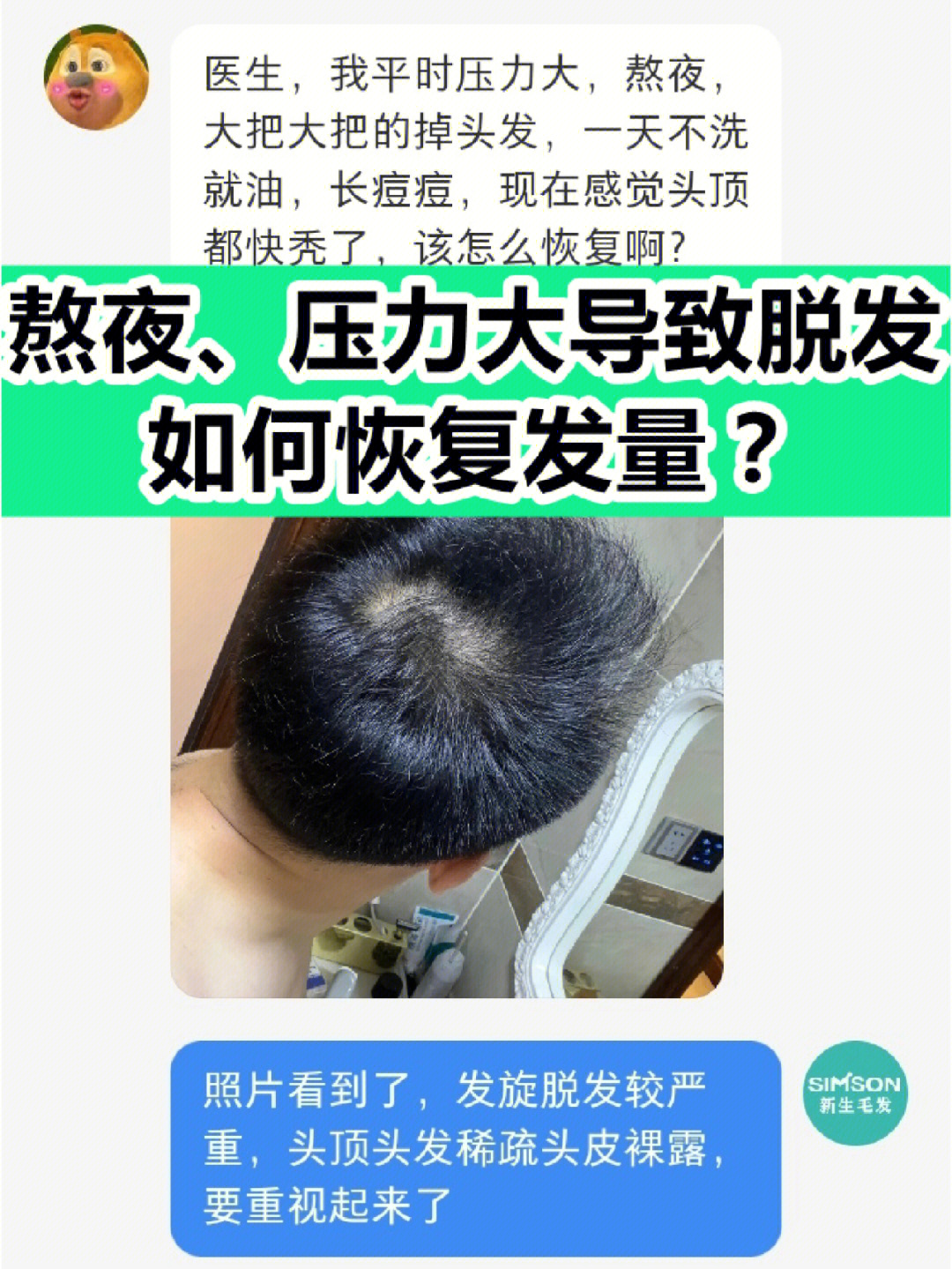 熬夜脱发怎么恢复图片