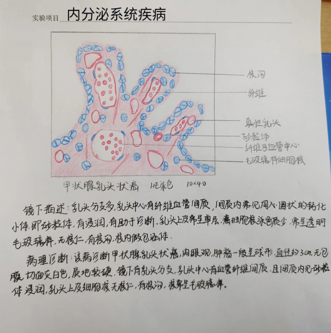 病理绘图内分泌系统疾病