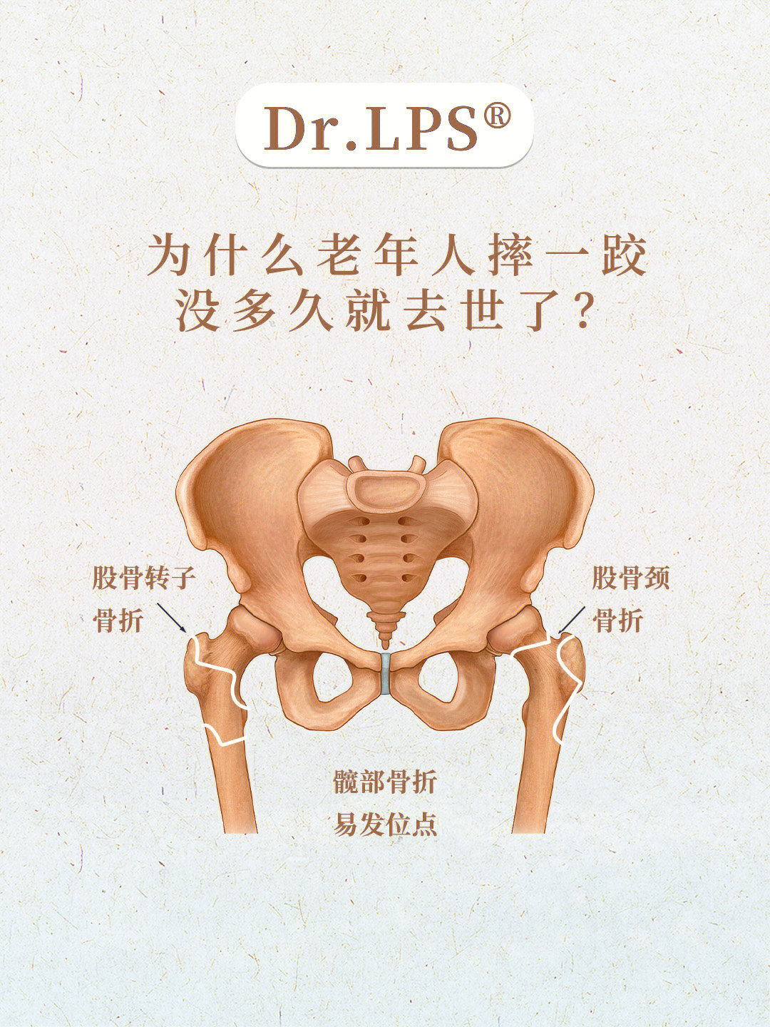 为什么老年人摔一跤没多久就去世了