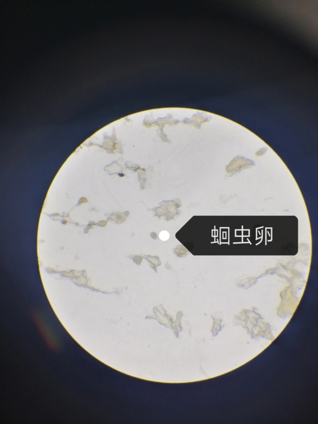 蛔虫卵胶囊图片