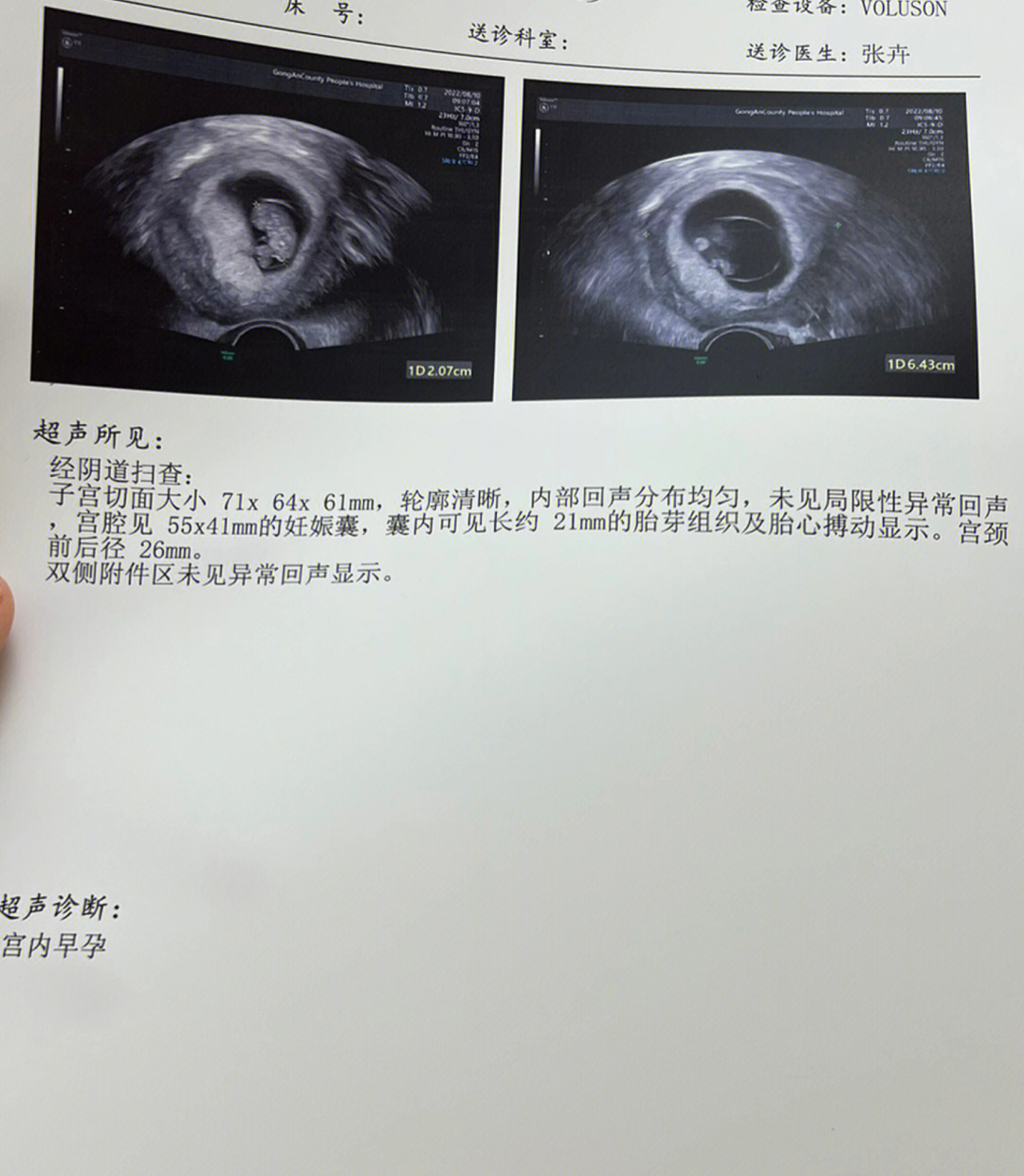 怀孕十周彩超单子图片图片