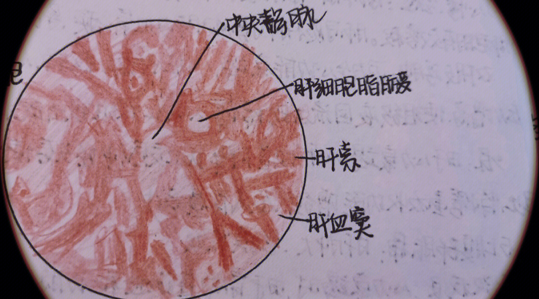 病理学实验报告手绘图