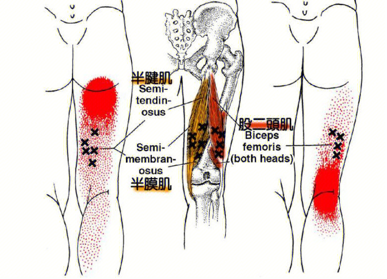股直肌酸痛图片