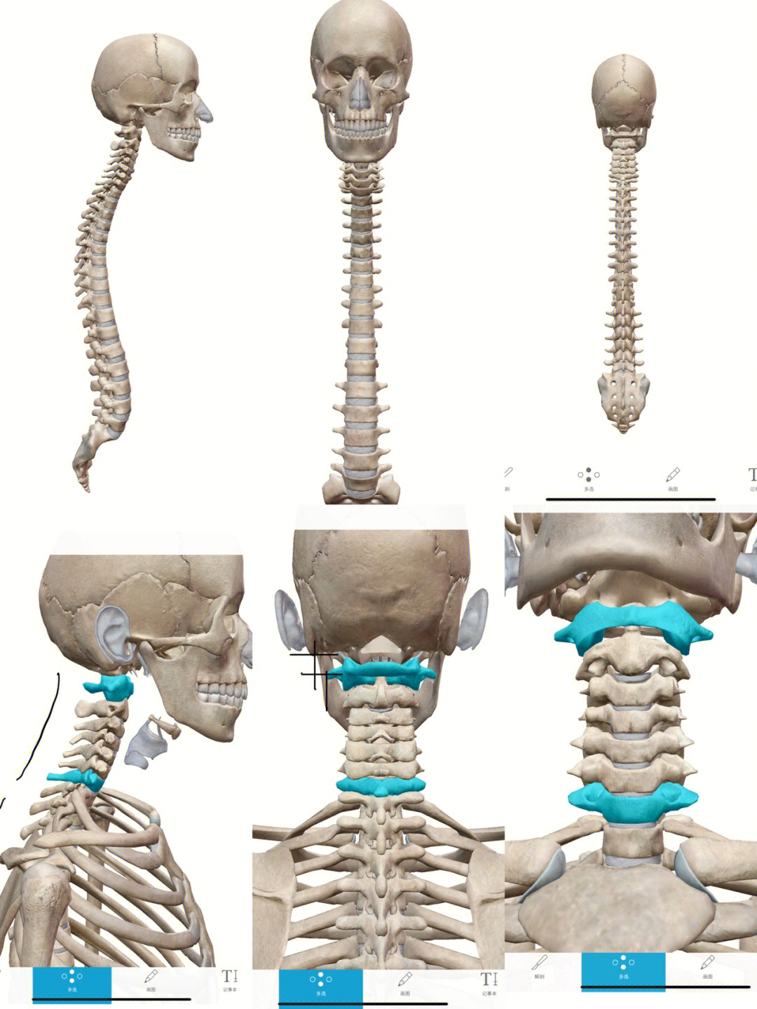 颈部解剖骨头图片