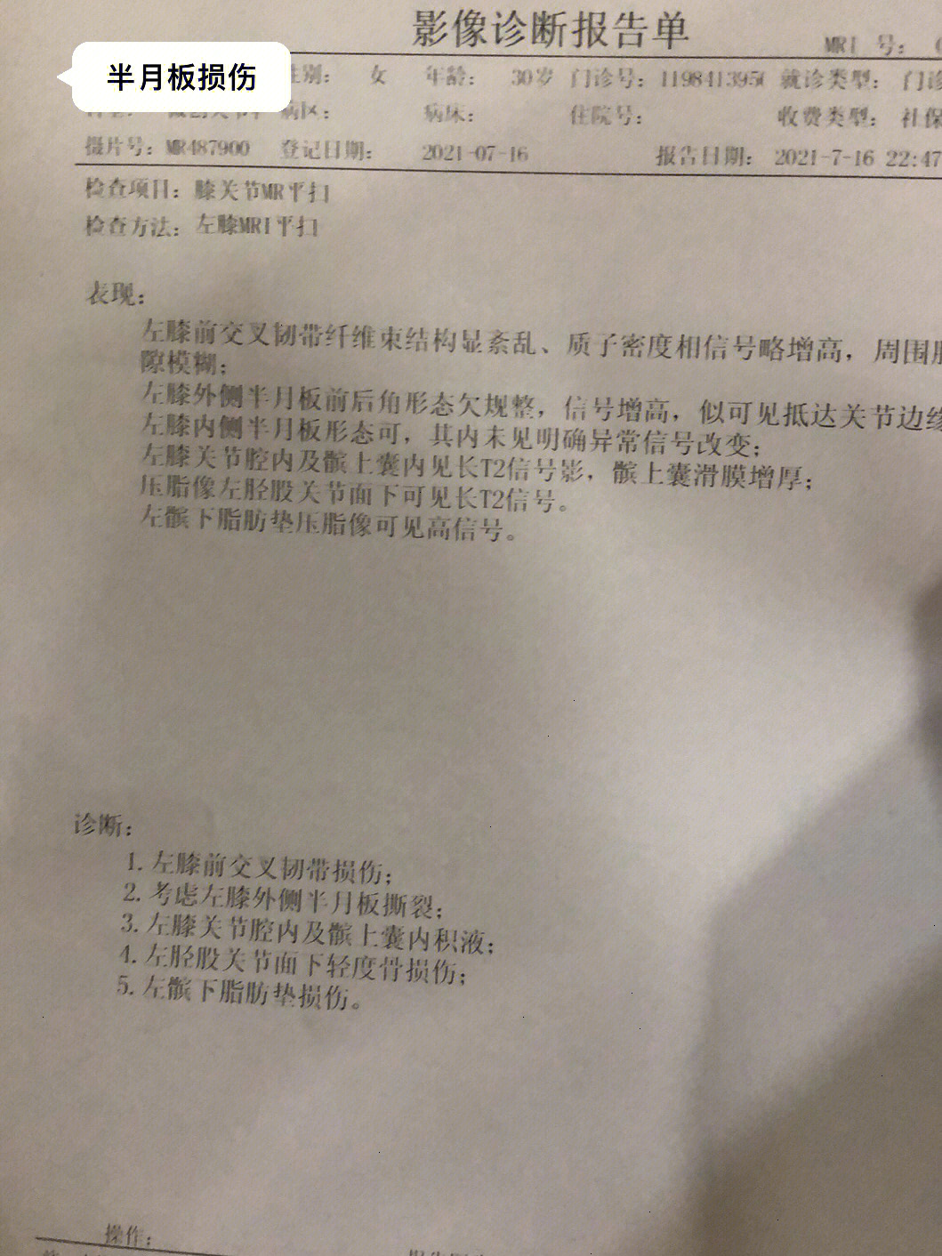 半月板损伤治疗心得