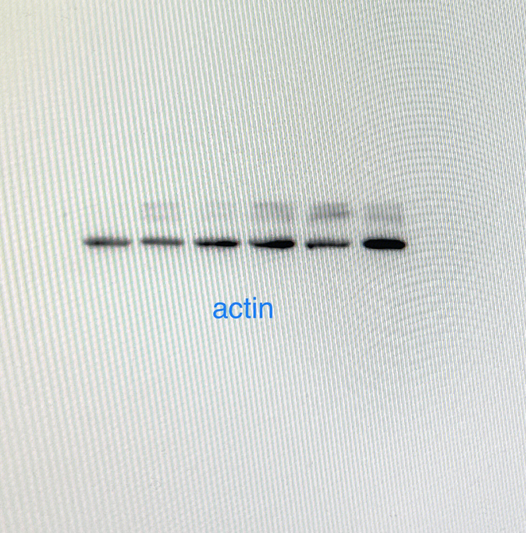 western blot 图片造假图片