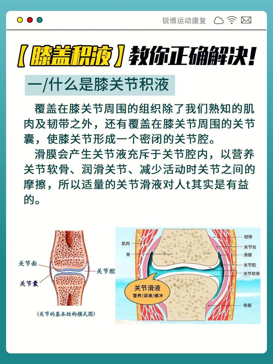 出现膝关节积液应该怎么办