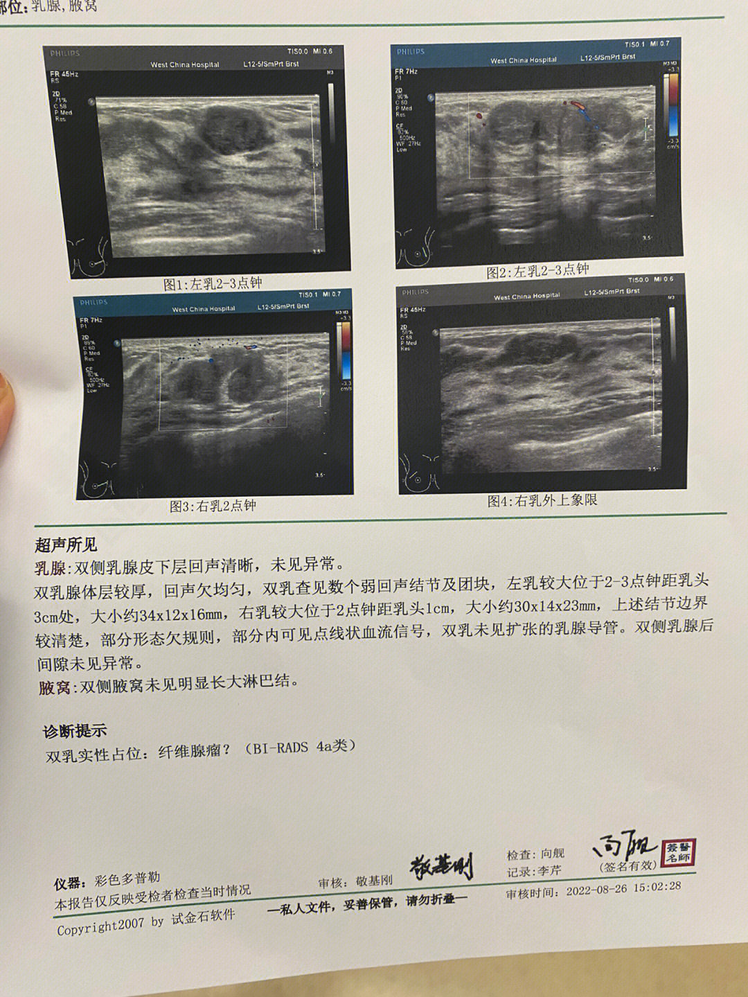 乳腺手术铺单示意图图片