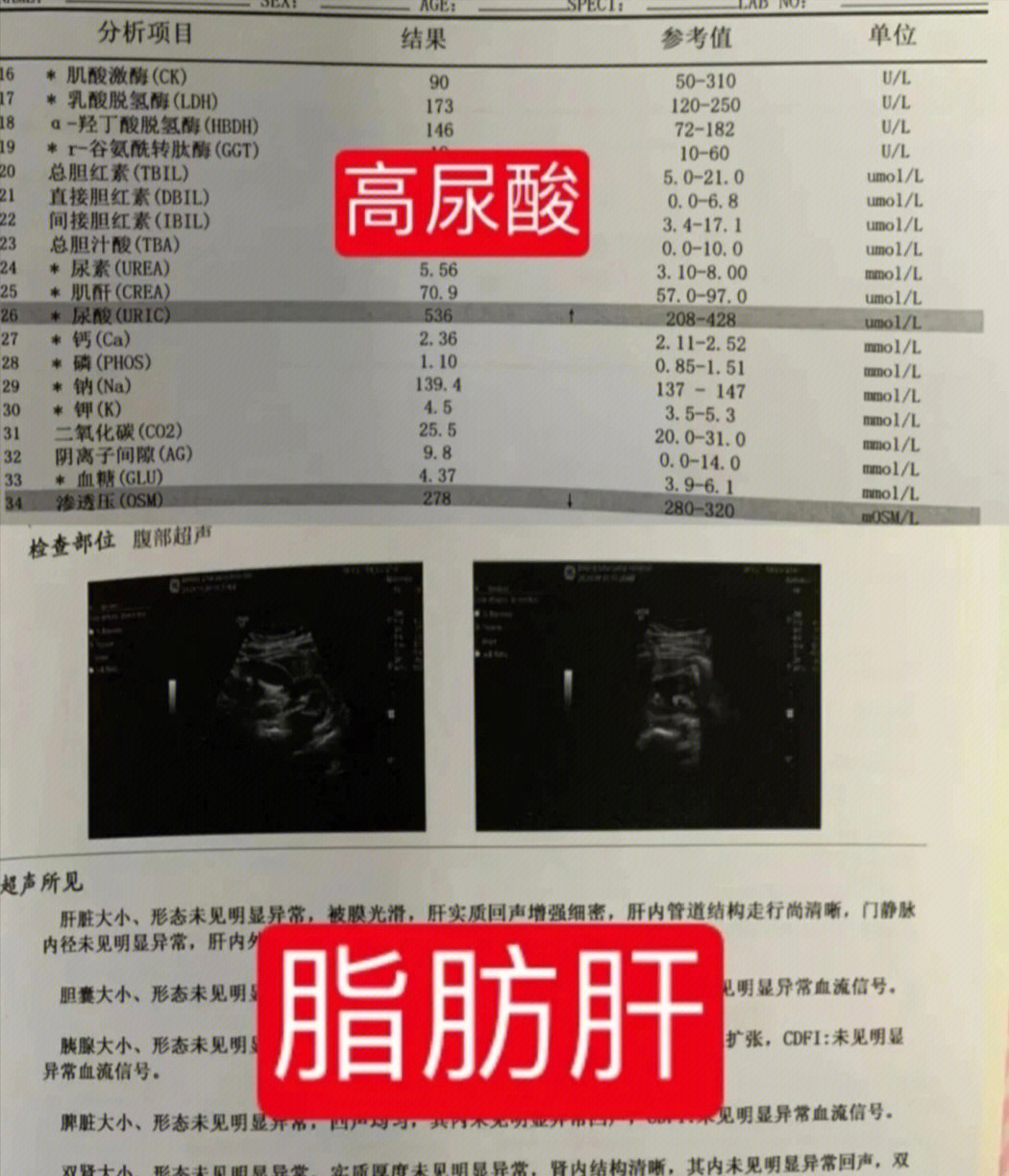 五灵胶囊逆转肝纤维化图片