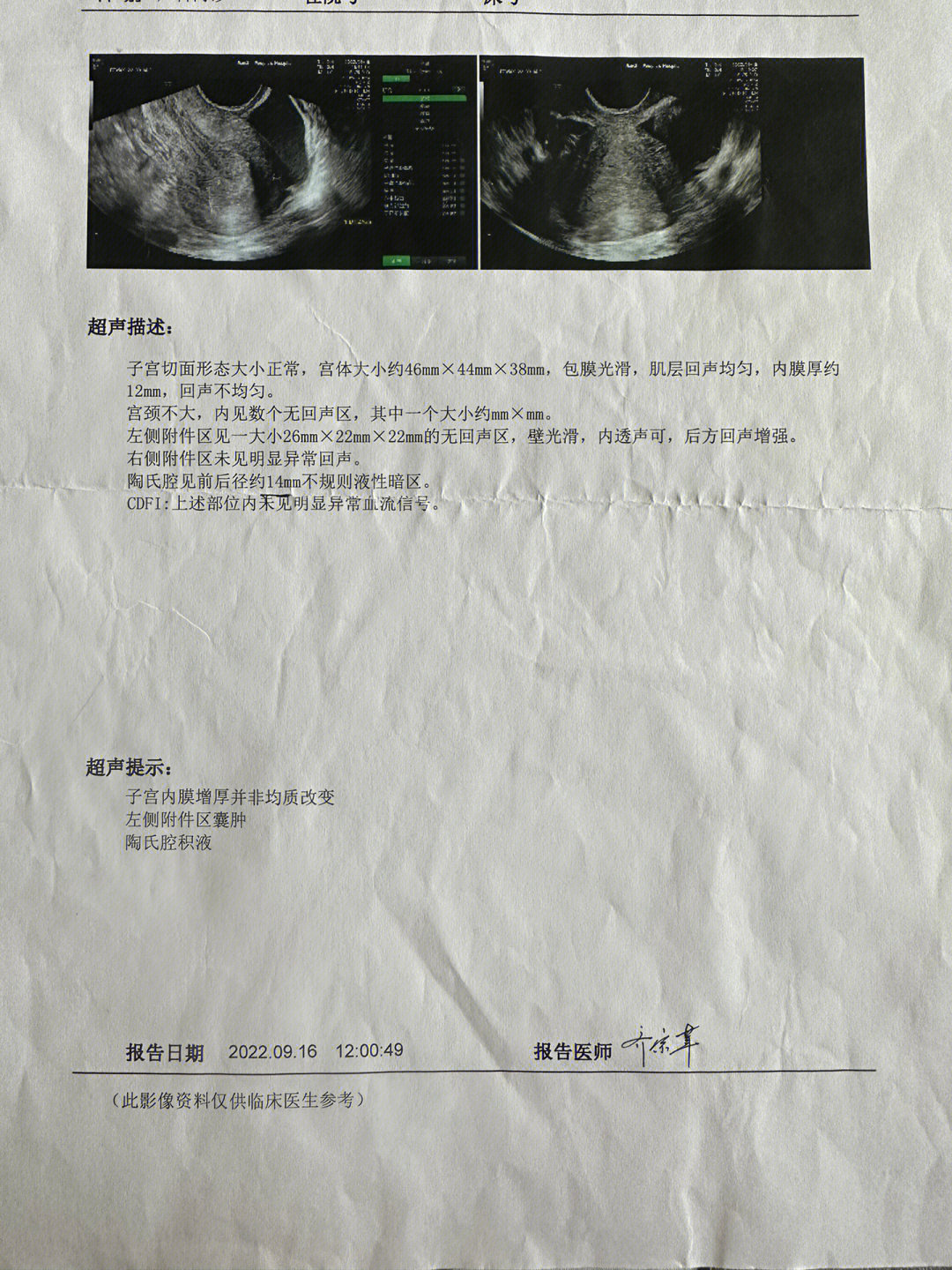 宫外孕保守治疗图片
