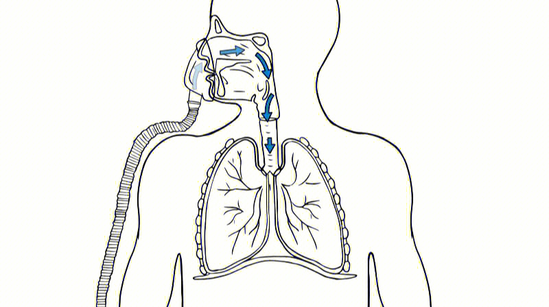 呼吸机简笔画图片