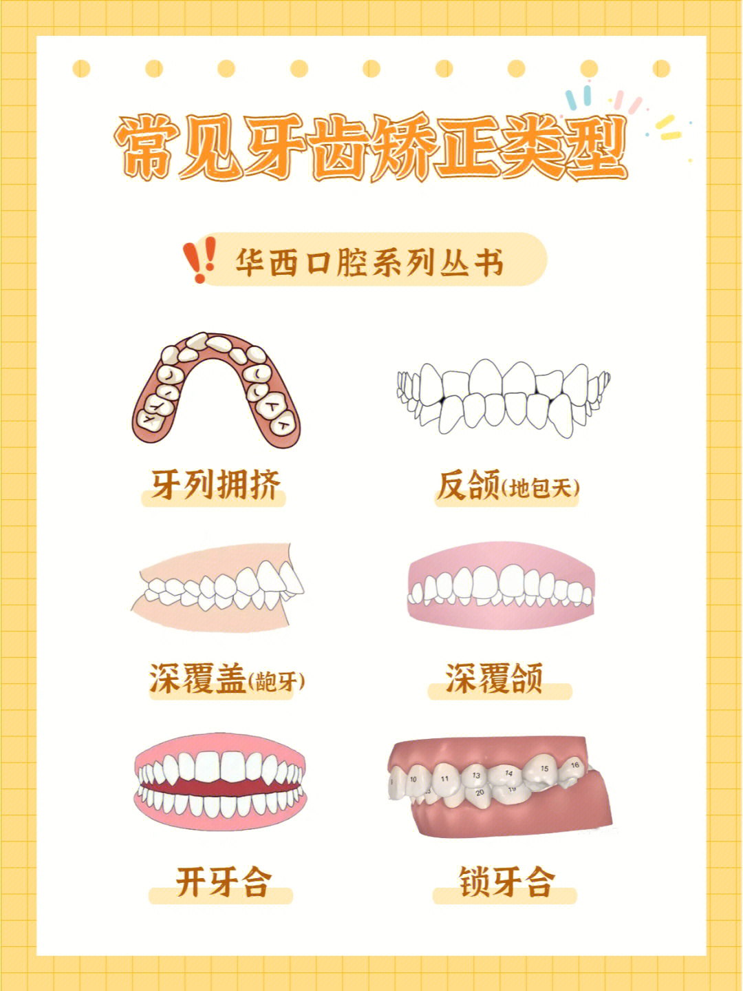 牙齿矫正类型梳理73参考自华西口腔系列丛书