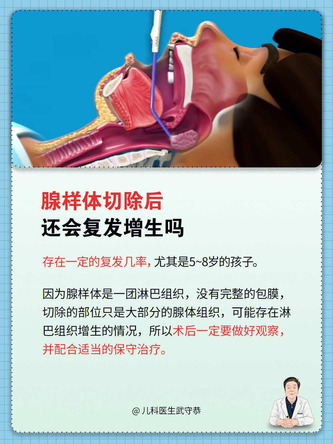 腺样体肥大的问题比较多,尤其用不用手术这件事,很多家长也比较担心.