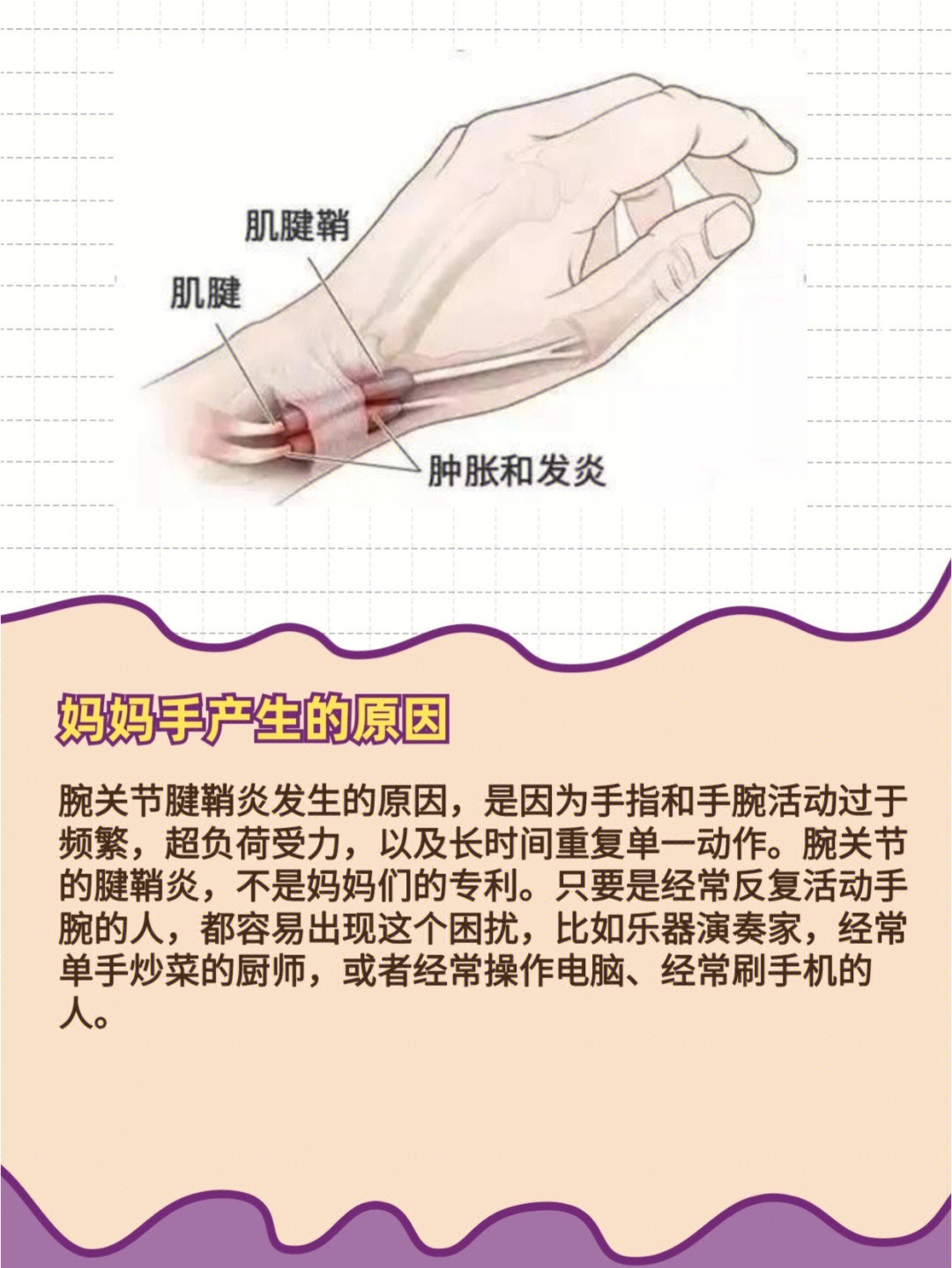 别大意这种产后疾病每个妈妈都躲不过