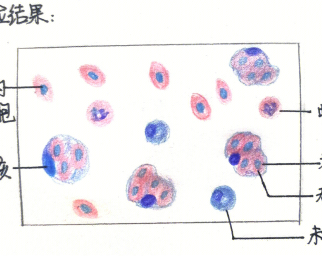 红细胞简图手绘图片