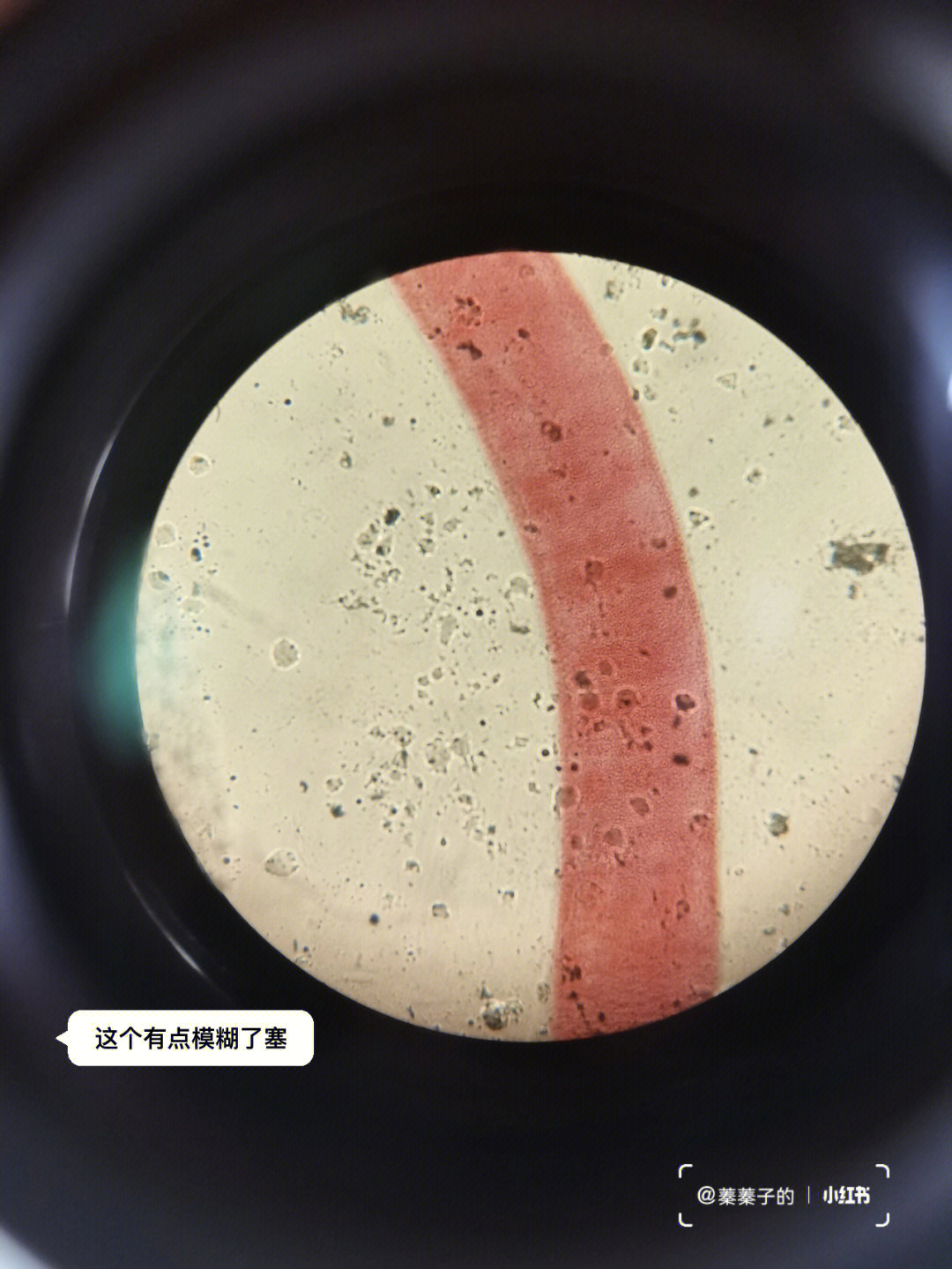 显微镜下的西瓜图片
