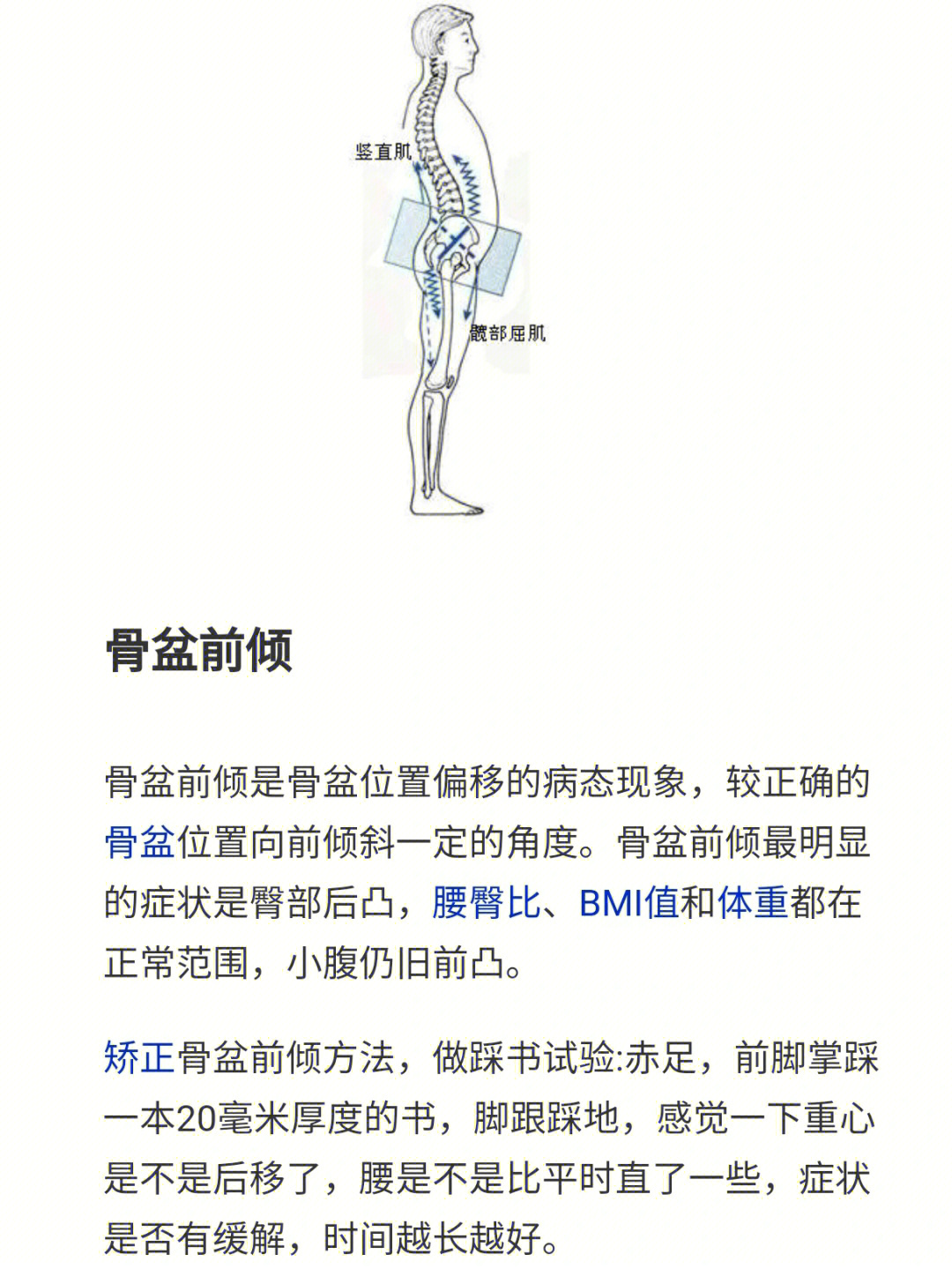 骨盆前倾有什么危害图片