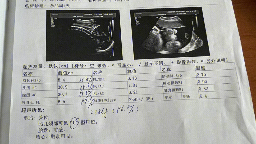 孕36周胎儿发育标准表图片