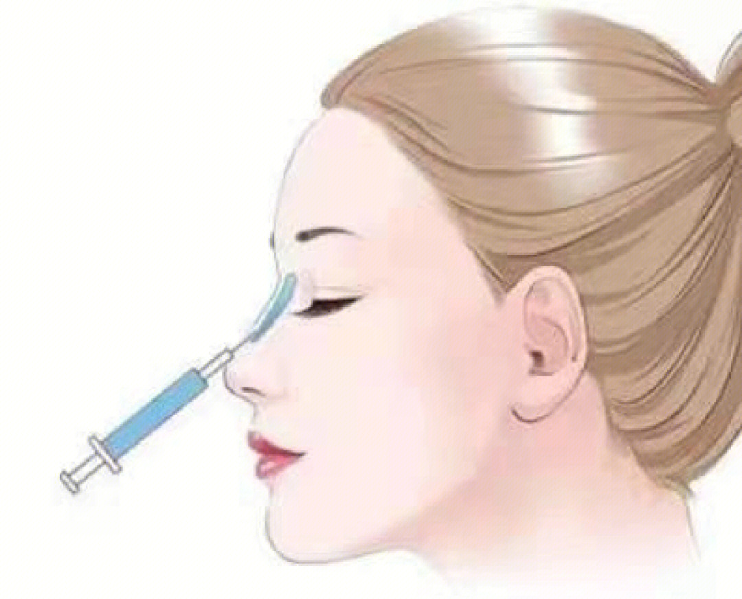 非手术治疗,通过注射玻尿酸之类填充物2:假体隆鼻,主要分两种(硅胶