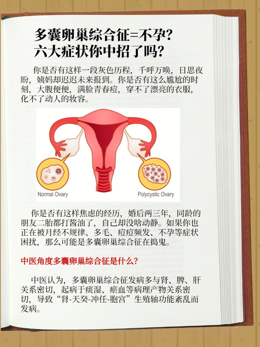 多囊卵巢综合征等于不孕吗