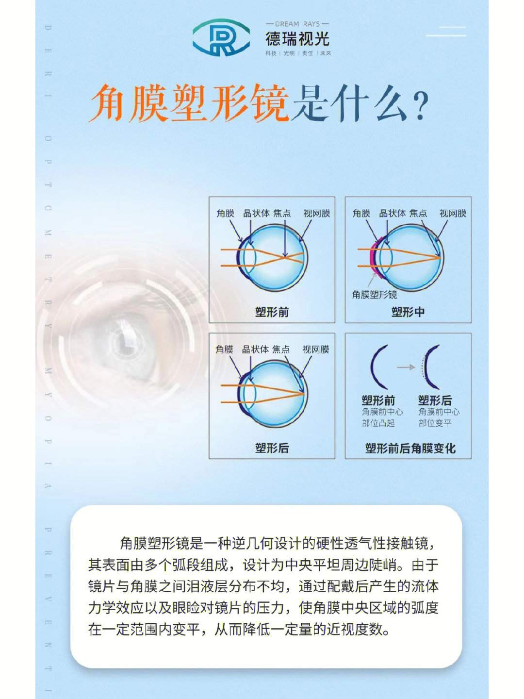 角膜高倍镜图片