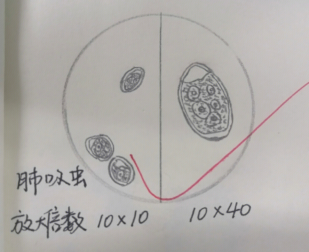 肺吸虫卵铅笔手绘图图片