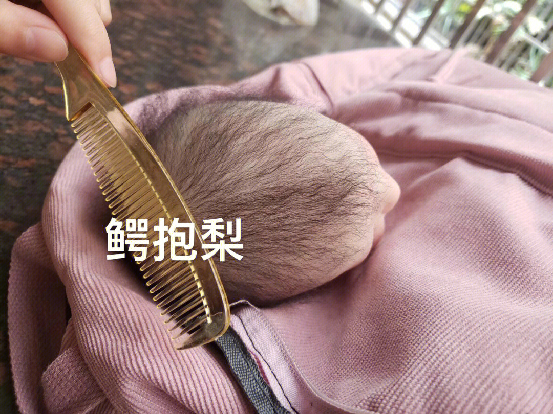 重生婴儿植发